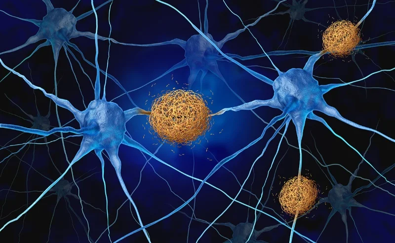 Could a Blood Test for Alzheimers Also Reveal Hidden Heart and Kidney ...